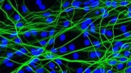 human_spiral_ganglion_cultured640-1